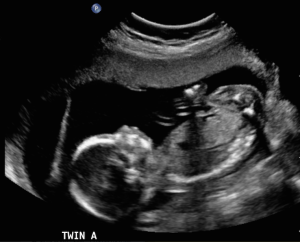 Screen Shot 2014-07-25 at 12.33.26 PM